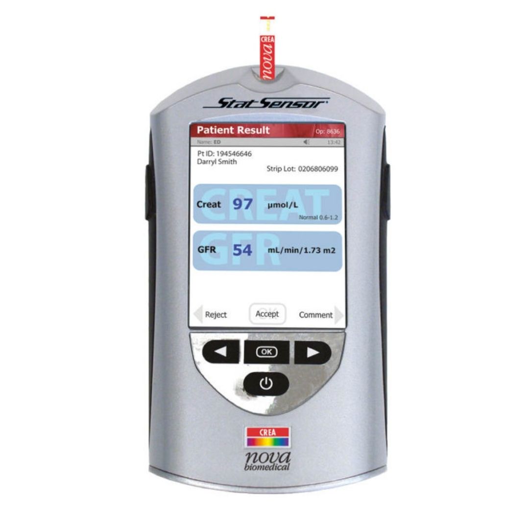 Analizador Stat Profile Prime Plus de Nova Biomedical